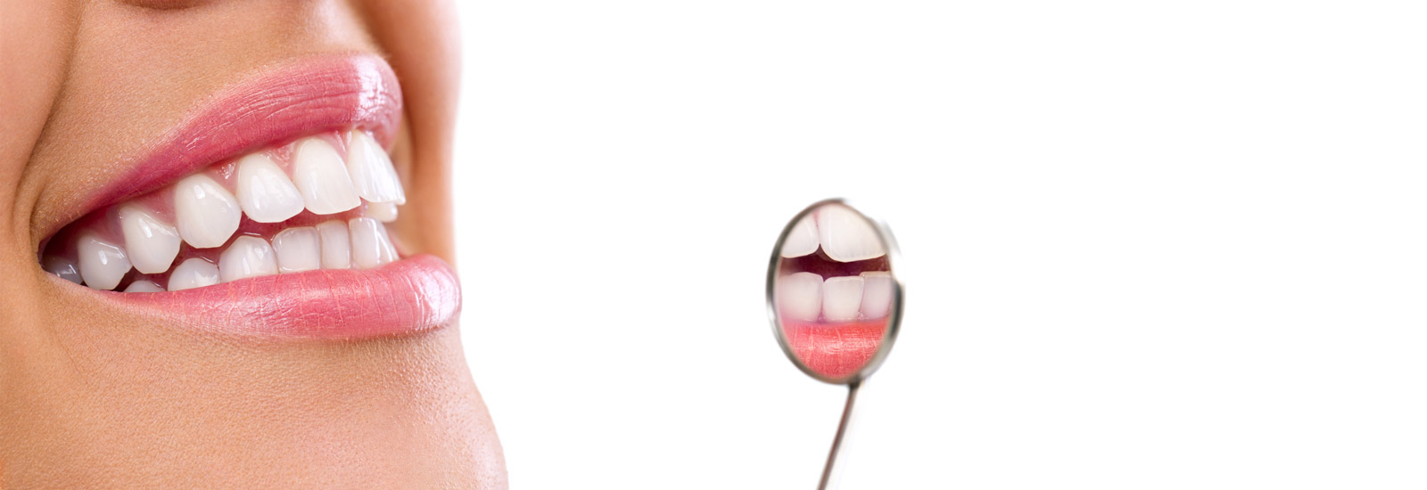 Teeth Whitening 3