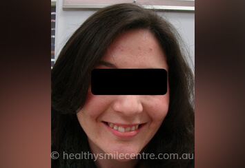 Healthy Smile Centre
