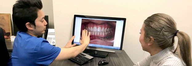 Patients teeth